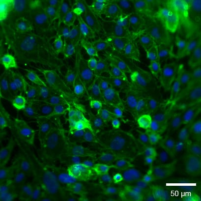 1739772446118418.png a234152c801c304d513b01f2e417ccf2.png